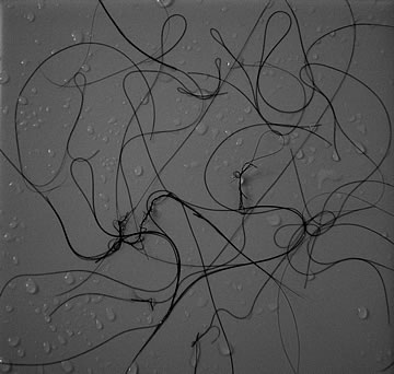 Your liver after the FDA failed to look after it.